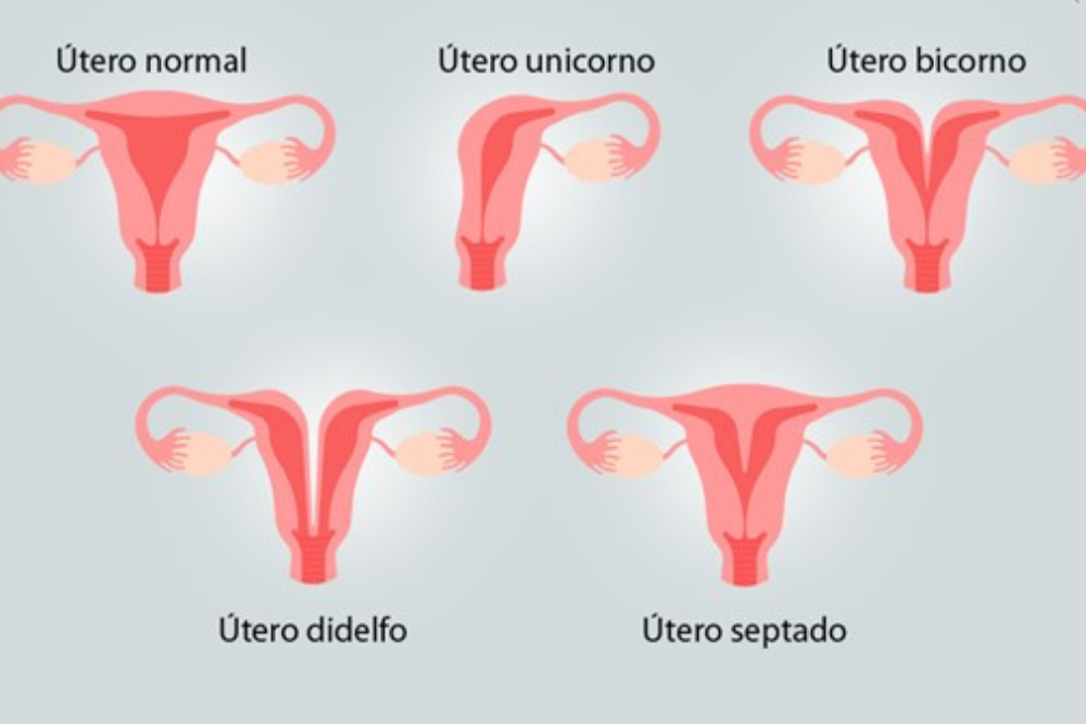 utero